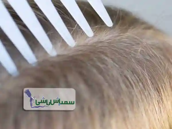 چگونه ساس را از شپش تشخیص دهیم؟