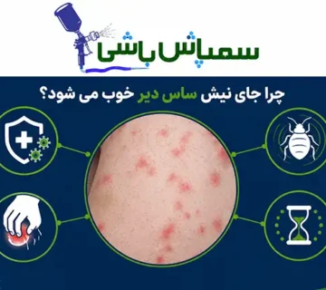 چرا جای نیش ساس دیر خوب می شود؟