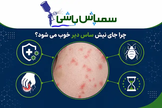 چرا جای نیش ساس دیر خوب می شود؟